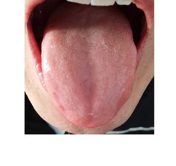 Healthy Tongue