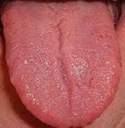 Red Tongue
